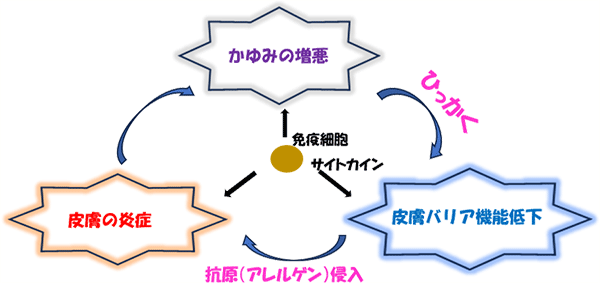 アトピー性皮膚炎の発症と増悪のメカニズム