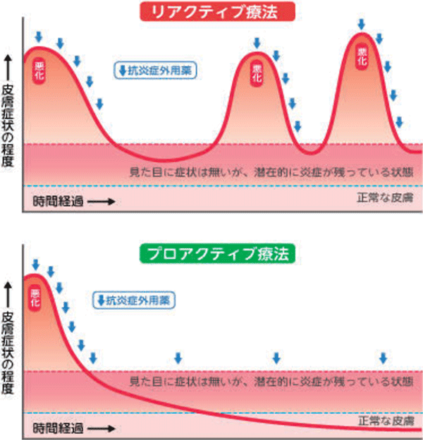 図：アトピー性皮膚炎診療ガイドライン2021より